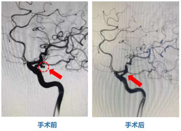 图片 4.png