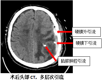 DM_20251114090312_002.png DM_20251114090312_002.png