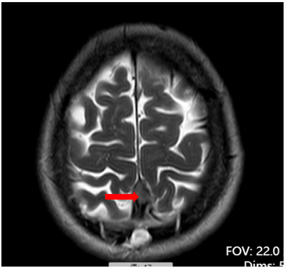 DM_20260202114001_002.png DM_20260202114001_002.png