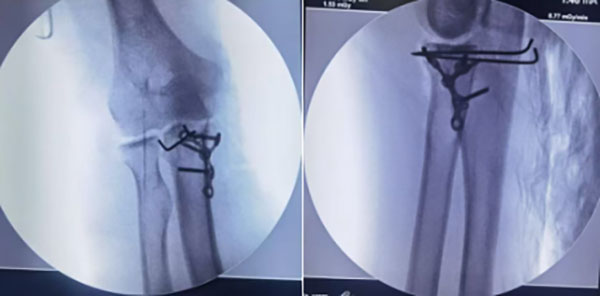 DM_20260401114413_002.jpg DM_20260401114413_002.jpg