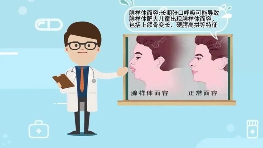 【怀医科普】腺样体肥大小科普