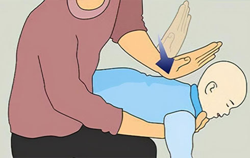 【怀医科普】海姆立克法指南更新！